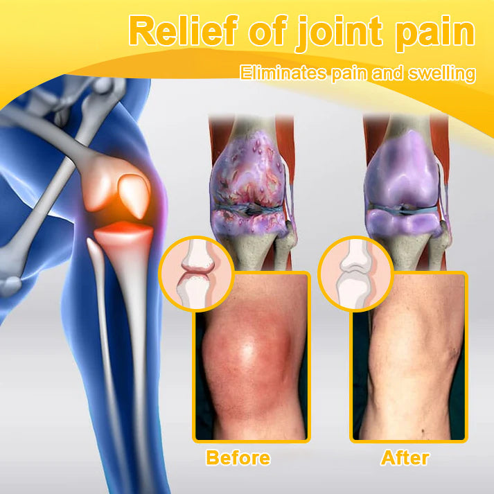 (š„LAST DAY SALE - 80% OFF) šAQA⢠Botulinum & Bee Essence Pain Relief Bone Healing Cream
