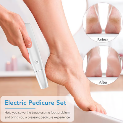 🎁Portable Electric Feet Callus Remover