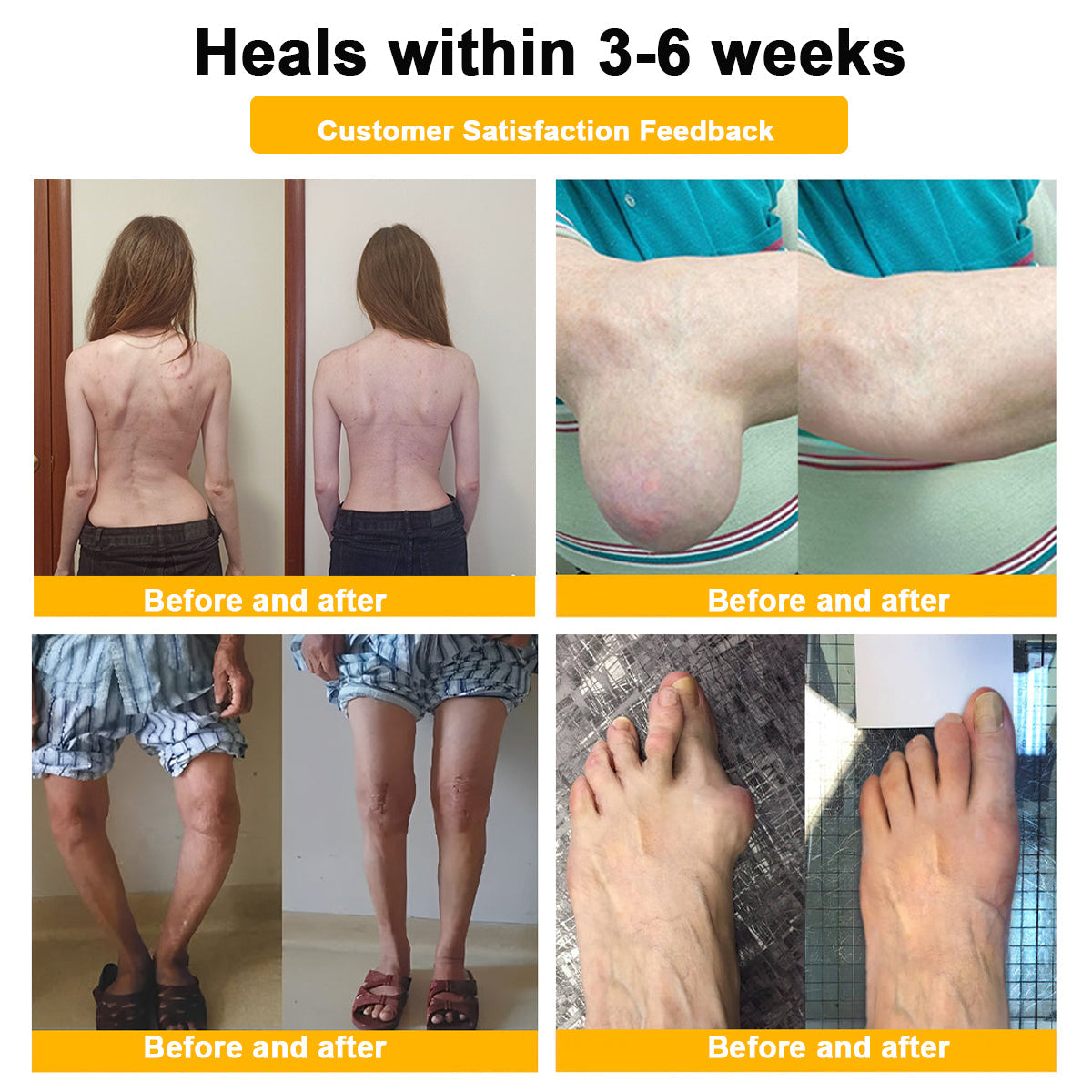 (🔥LAST DAY SALE - 80% OFF) 🐝AQA™ Botulinum & Bee Essence Pain Relief Bone Healing Cream