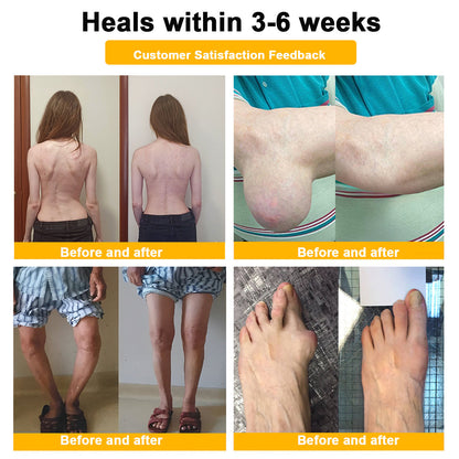 (🔥LAST DAY SALE - 80% OFF) 🐝AQA™ Botulinum & Bee Essence Pain Relief Bone Healing Cream