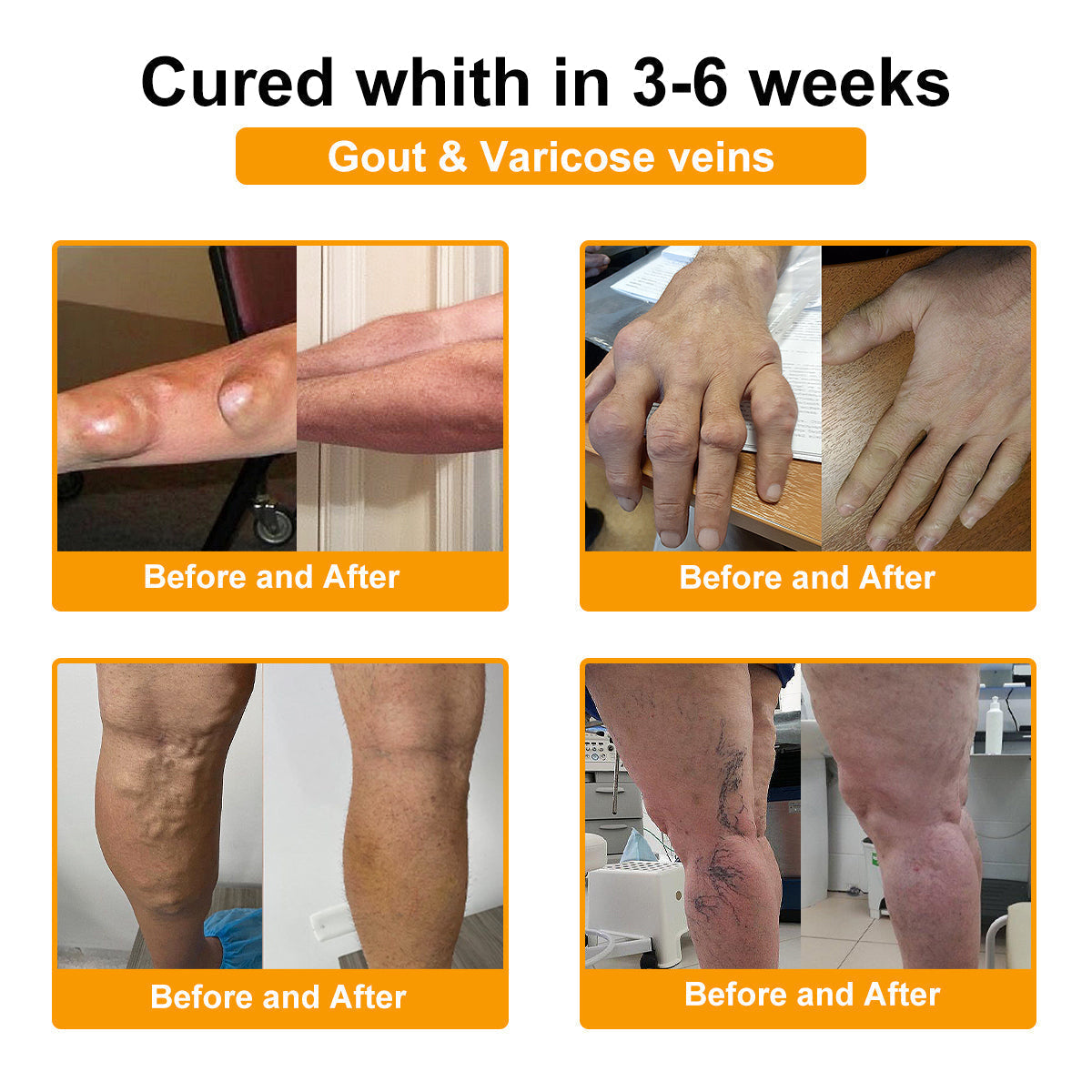(🔥LAST DAY SALE - 80% OFF) 🐝AQA™ Botulinum & Bee Essence Pain Relief Bone Healing Cream
