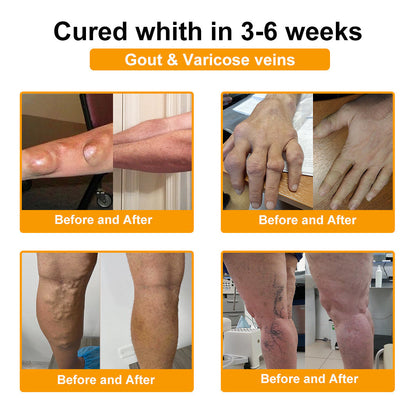 (🔥LAST DAY SALE - 80% OFF) 🐝AQA™ Botulinum & Bee Essence Pain Relief Bone Healing Cream