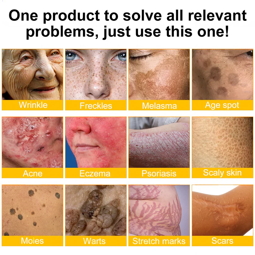 👨‍⚕️ Rolimey® Bee venom Pro Comprehensive Cream —Tightening for Skin Types 🔥