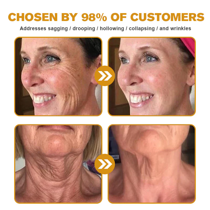 👨‍⚕️ Rolimey® Bee venom Pro Comprehensive Cream —Tightening for Skin Types 🔥