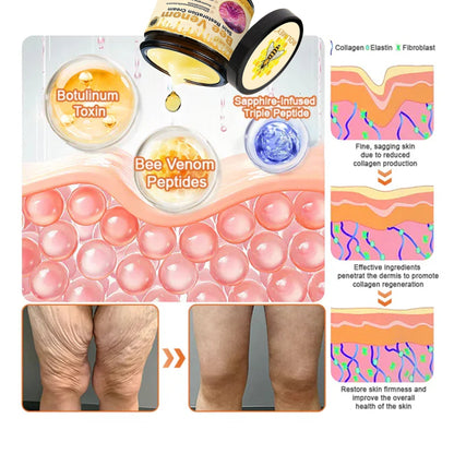 👨‍⚕️ Rolimey® Bee venom Pro Comprehensive Cream —Tightening for Skin Types 🔥