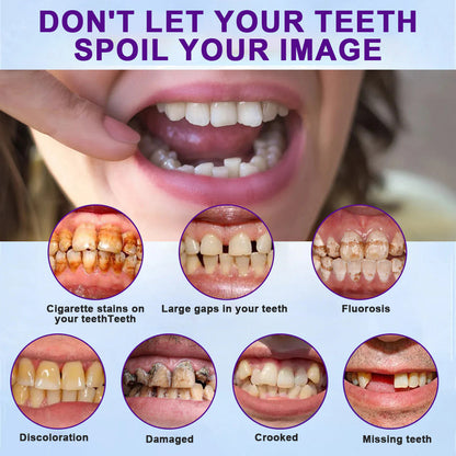 Rediscover Comfort & Confidence — Introducing the LOVILDS™ Silicone-Lined Denture Set