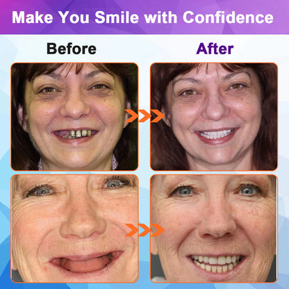 Rediscover Comfort & Confidence — Introducing the LOVILDS™ Silicone-Lined Denture Set