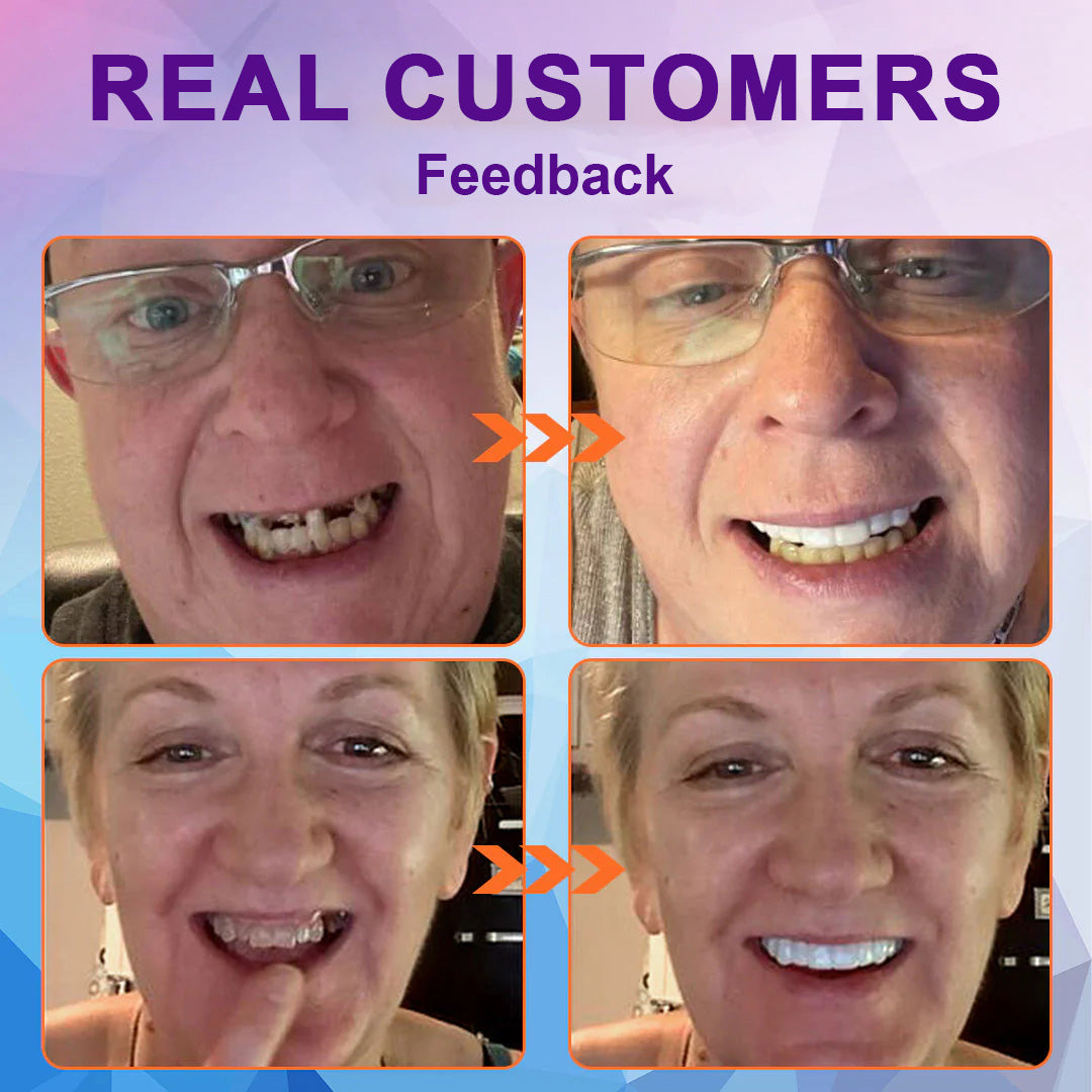 Rediscover Comfort & Confidence — Introducing the LOVILDS™ Silicone-Lined Denture Set
