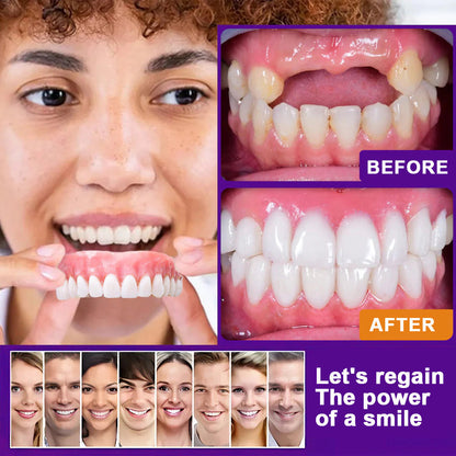 Rediscover Comfort & Confidence — Introducing the LOVILDS™ Silicone-Lined Denture Set