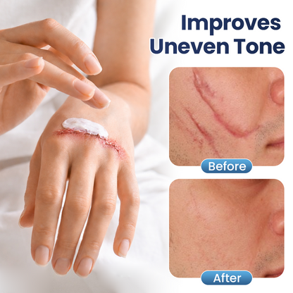 🔥Last Day Discount🔥 Nexisify® DERMALUX Texture Repair Gel