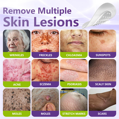 GFOUK® Soluble Microneedle Botanical Skin Tag Removal Patch🍇🍇🍇