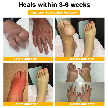 (🔥LAST DAY SALE - 80% OFF) 🐝AQA™ Botulinum & Bee Essence Pain Relief Bone Healing Cream