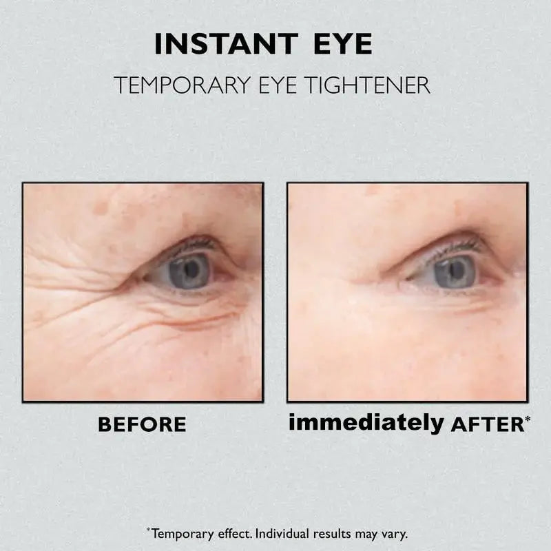 (✨Buy 2 Get 1 Free💕)AQA™ Instant Eye Temporary Eye Tightener🔥Last Day Sale 50% OFF🔥