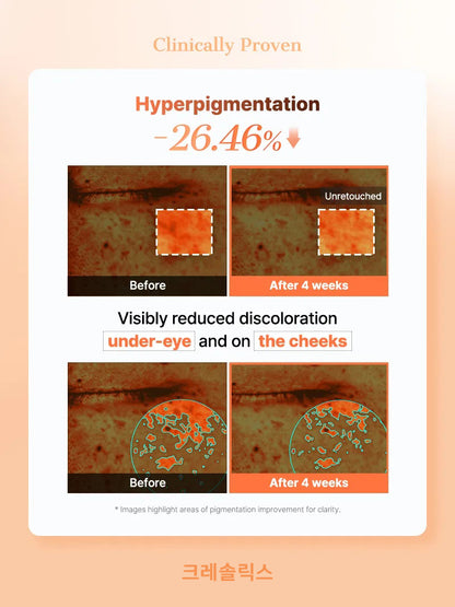 South Korea 5 PDRN Collagen Vitalizing Hydrogel Eye Patch