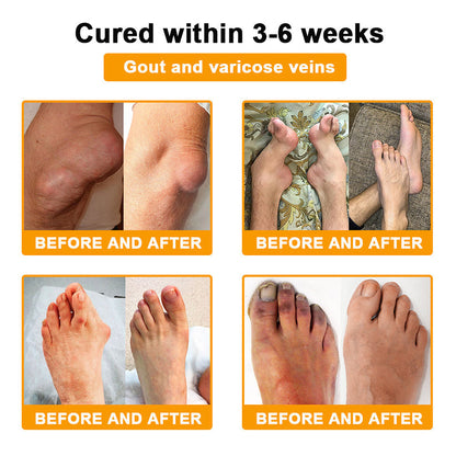 (🔥LAST DAY SALE - 80% OFF) 🐝AQA™ Botulinum & Bee Essence Pain Relief Bone Healing Cream