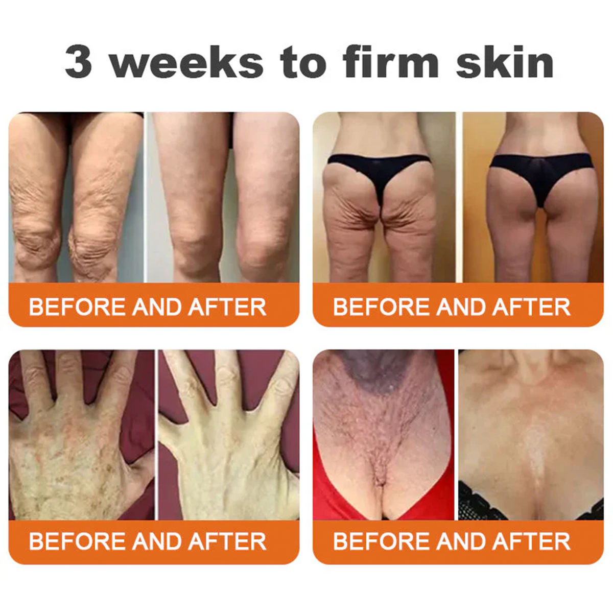 👨‍⚕️ Rolimey® Bee venom Pro Comprehensive Cream —Tightening for Skin Types 🔥