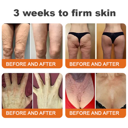 👨‍⚕️ Rolimey® Bee venom Pro Comprehensive Cream —Tightening for Skin Types 🔥