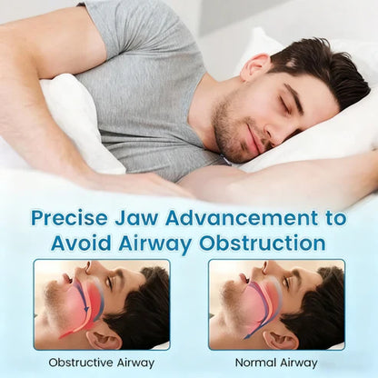 PerfectSleep Solution- AntiSnoring & Anti-Grinding Teeth Protector