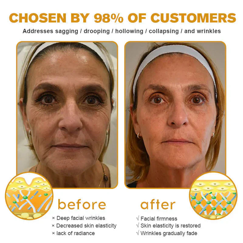 Lovilds™ Bee Venom Wrinkle Removal Cream