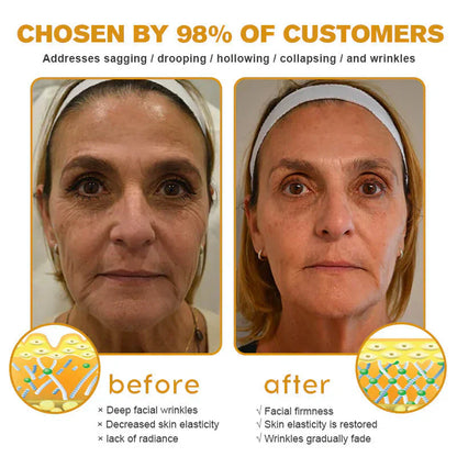 Lovilds™ Bee Venom Wrinkle Removal Cream