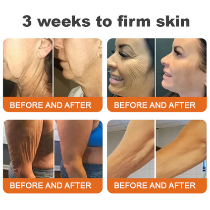 👨‍⚕️ Rolimey® Bee venom Pro Comprehensive Cream —Tightening for Skin Types 🔥