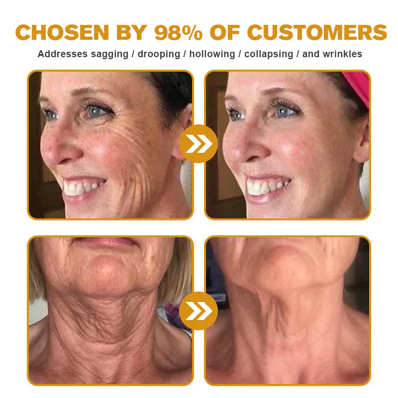 Lovilds™ Bee Venom Wrinkle Removal Cream