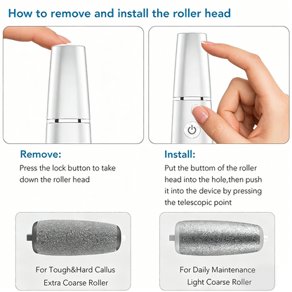 🎁Portable Electric Feet Callus Remover