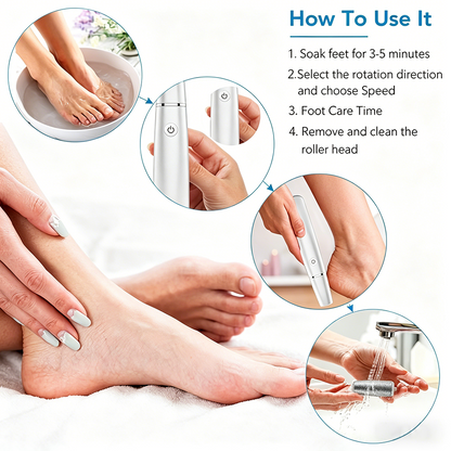 🎁Portable Electric Feet Callus Remover